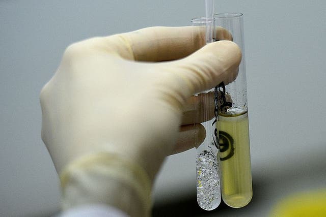 <p>A urine sample at France’s national anti-doping lab near Paris, 2015</p>